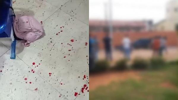 Adolescente baleado por colega dentro de escola em Igaci segue em recuperação no hospital